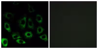 Protéine Recombinante Hepatite B virus Hepatite B Surface Antigen AD 100 µg
