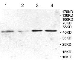 Tampon d'Extraction 5X PTR 50 ml