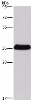 Kit de Dosage Activité Collagenase (Colorimétrique) 100 Tests