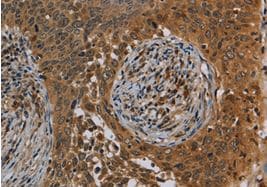 Kit de Dosage Glutamine (Colorimétrique) 100 Tests