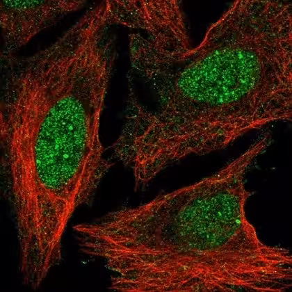 Protéine Recombinante Humain synucléine alpha, monomère (Active) 100 µg