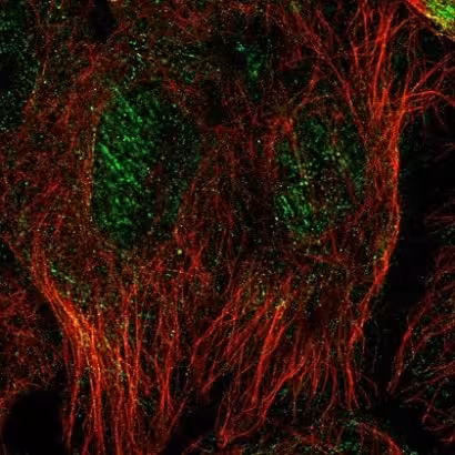 Protéine Recombinante Humain synucléine alpha, aggrégat (Active) 100 µg