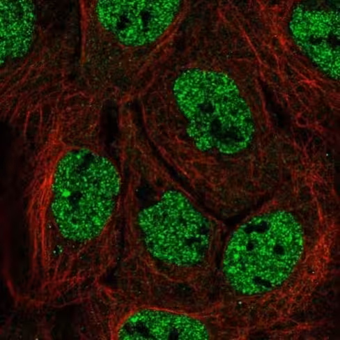 Kit de Coloration des Membranes plasmiques cellulaires - Fluorescence Orange - Cytopainter 500 Tests
