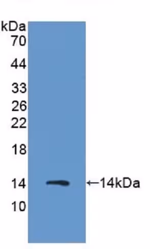 Inhibiteur Rac GTPase, EHop-016 5 mg