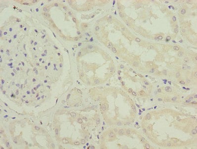 Réactif Rhodamine Phalloidine 300 Tests