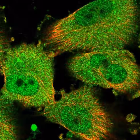 Protéine Recombinante Souris Prokineticine 2/PK2 20 µg