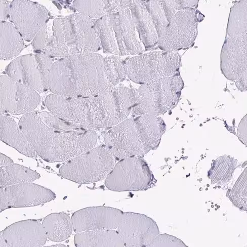 Protéine recombinante humain Interferon gamma (Active) 10 µg