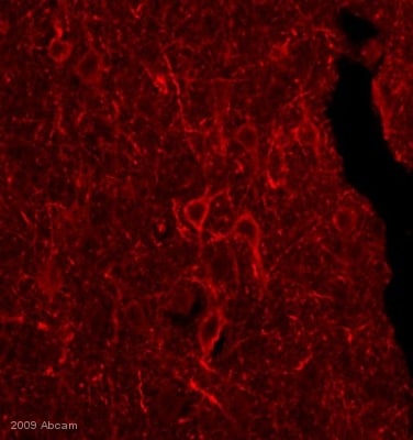Kit ELISA Humain IL-1 beta 96 Tests