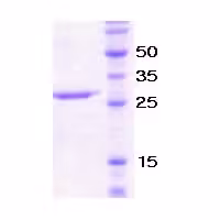 Protéine recombinante humain TGF beta 1 (Active) 10 µg