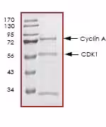 Protéine Humain Thrombine Native (Active) 100 µg