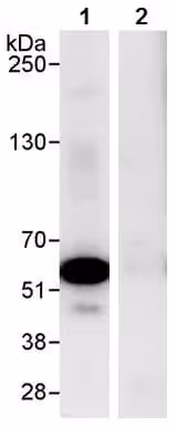 Protéine recombinante humain ABL1 5 µg
