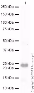 Protéine recombinante humain Lipocaline-2 / NGAL 100 µg