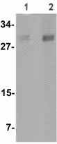 Kit de Dosage Peroxyde d'hydrogène 200 Tests