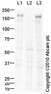 Protéine Native Humaine IgA1 1 mg