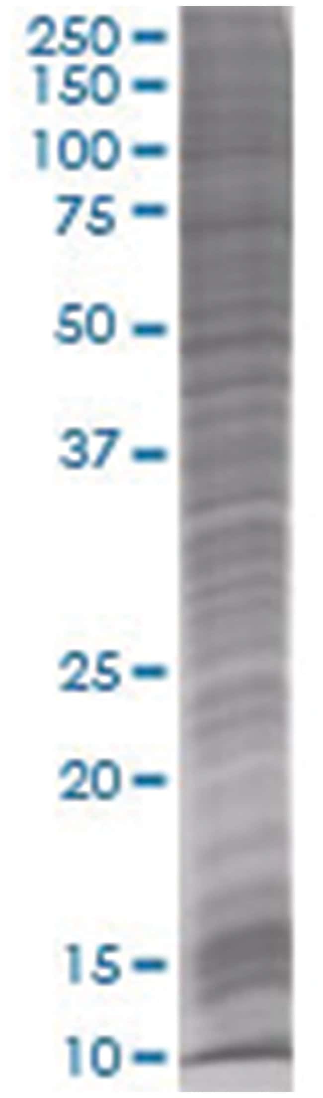 Ogn 293t cell transient overexpress ion lysate (denatured) 100 µl
