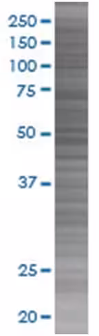 Omp 293t cell transient overexpress ion lysate (denatured) 100 µl