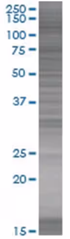 Orc1l 293t cell transient overexpre ssion lysate (denatured) 100 µl