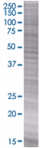 Osm 293t cell transient overexpress ion lysate (denatured) 100 µl