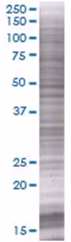 P2ry2 293t cell transient overexpre ssion lysate (denatured) 100 µl