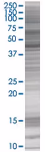 Pah 293t cell transient overexpress ion lysate (denatured) 100 µl