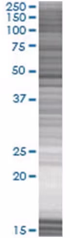 Pax6 293t cell transient overexpres sion lysate (denatured) 100 µl