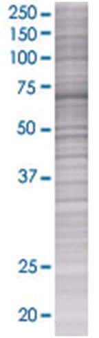 Pck1 293t cell transient overexpres sion lysate (denatured) 100 µl