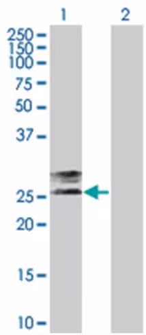 Pcoln3 293t cell transient overexpr ession lysate (denatured) 100 µl