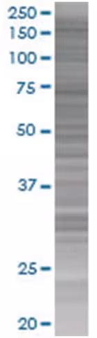 Pdgfra 293t cell transient overexpr ession lysate (denatured) 100 µl
