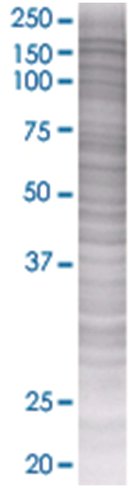 Pdgfrb 293t cell transient overexpr ession lysate (denatured) 100 µl