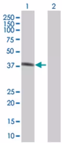 Pgc 293t cell transient overexpress ion lysate (denatured) 100 µl