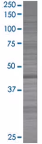 Phkg2 293t cell transient overexpre ssion lysate (denatured) 100 µl