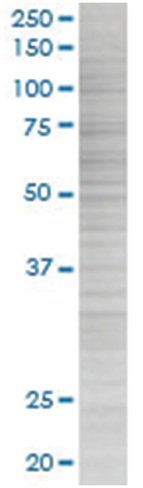 Pknox1 293t cell transient overexpr ession lysate (denatured) 100 µl