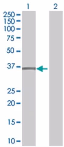 Plscr1 293t cell transient overexpr ession lysate (denatured) 100 µl