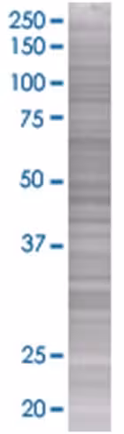 Pltp 293t cell transient overexpres sion lysate (denatured) 100 µl