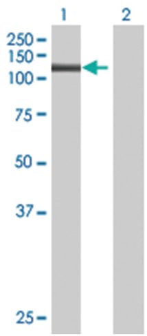 Pms2 293t cell transient overexpres sion lysate (denatured) 100 µl