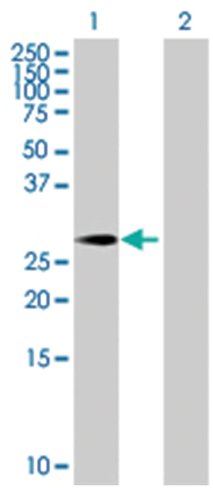 Prrx1 293t cell transient overexpre ssion lysate (denatured) 100 µl