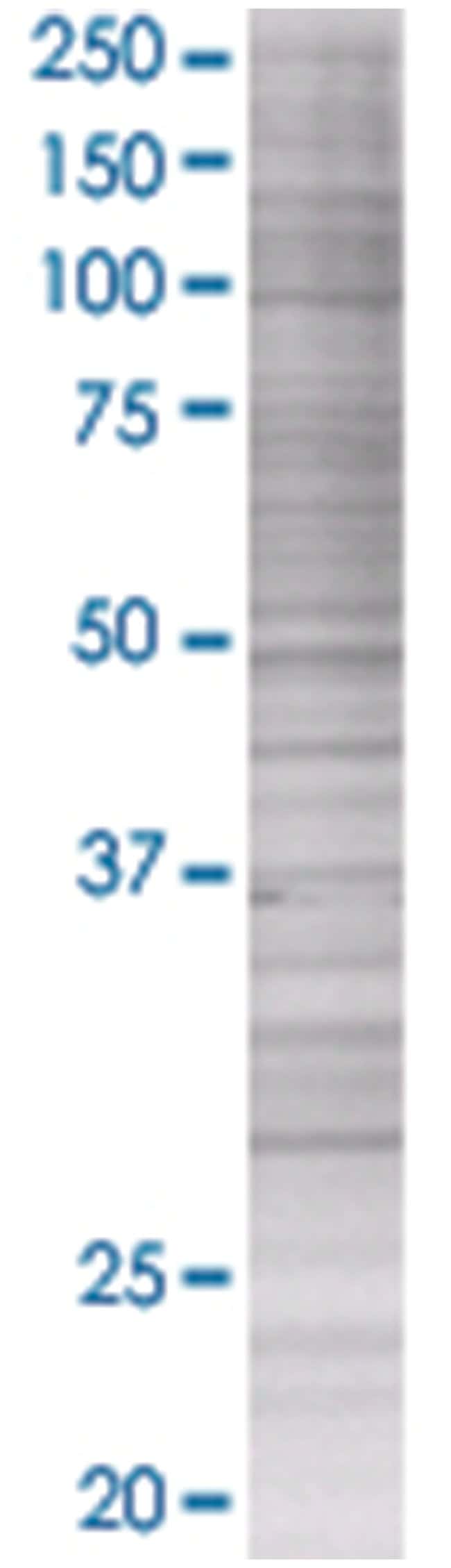 Pnmt 293t cell transient overexpres sion lysate (denatured) 100 µl