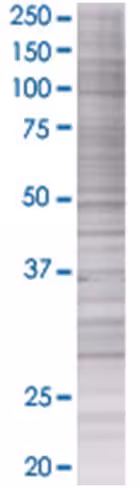 Pnmt 293t cell transient overexpres sion lysate (denatured) 100 µl