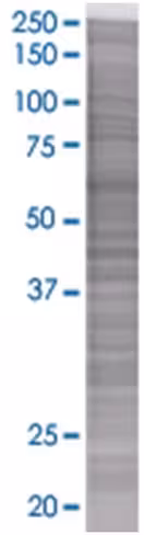 Pole 293t cell transient overexpres sion lysate (denatured) 100 µl