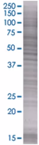 Ppara 293t cell transient overexpre ssion lysate (denatured) 100 µl