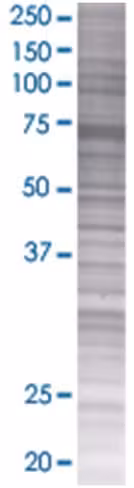Ppef1 293t cell transient overexpre ssion lysate (denatured) 100 µl