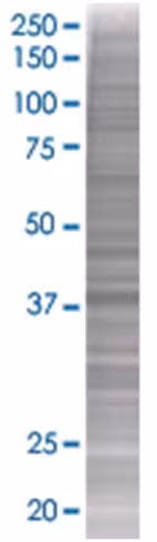 Ppid 293t cell transient overexpres sion lysate (denatured) 100 µl