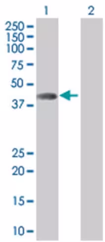 Ppm1a 293t cell transient overexpre ssion lysate (denatured) 100 µl