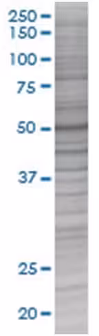 Ppm1b 293t cell transient overexpre ssion lysate (denatured) 100 µl