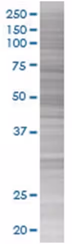 Ppox 293t cell transient overexpres sion lysate (denatured) 100 µl