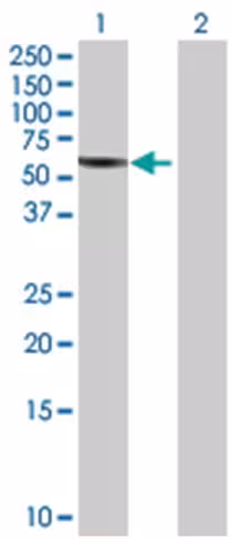 Ppp2r1b 293t cell transient overexp ression lysate (denatured) 100 µl