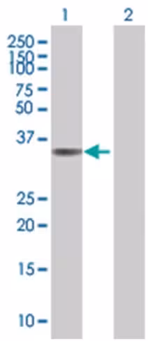 Ppp2r4 293t cell transient overexpr ession lysate (denatured) 100 µl
