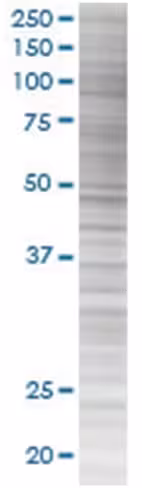 Ppp3r2 293t cell transient overexpr ession lysate (denatured) 100 µl