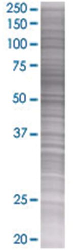 Prf1 293t cell transient overexpres sion lysate (denatured) 100 µl