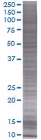 Prg2 293t cell transient overexpres sion lysate (denatured) 100 µl